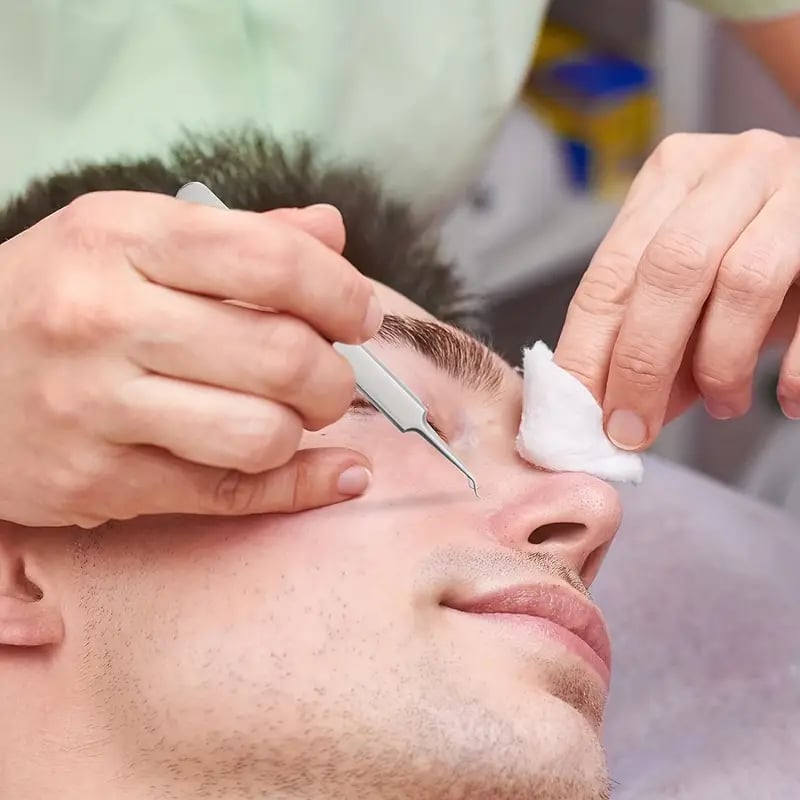 Professional Blackhead Tweezers