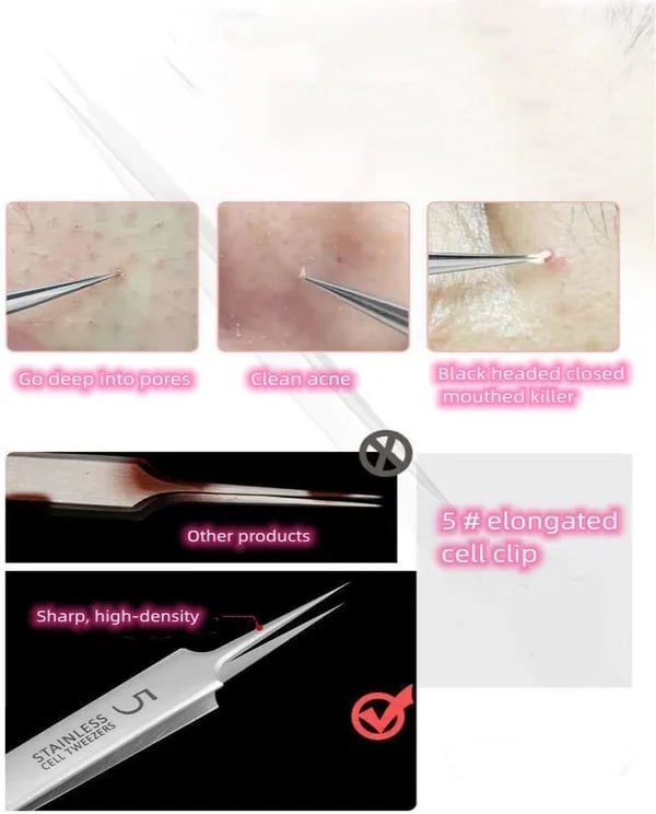 Professional Blackhead Tweezers